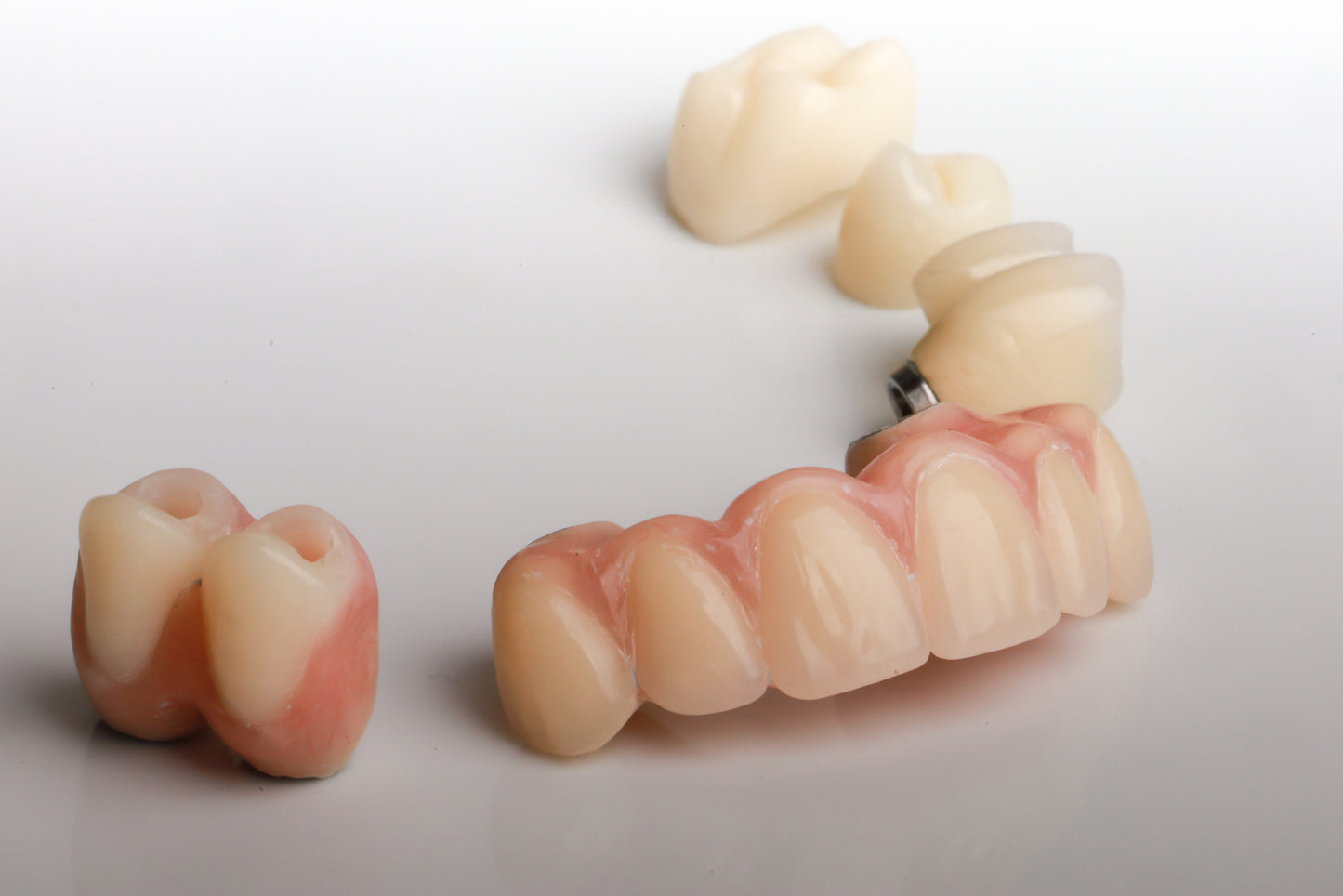implantesdentales-implantes-drdanielcapetilllo-protesis-implantosoportado