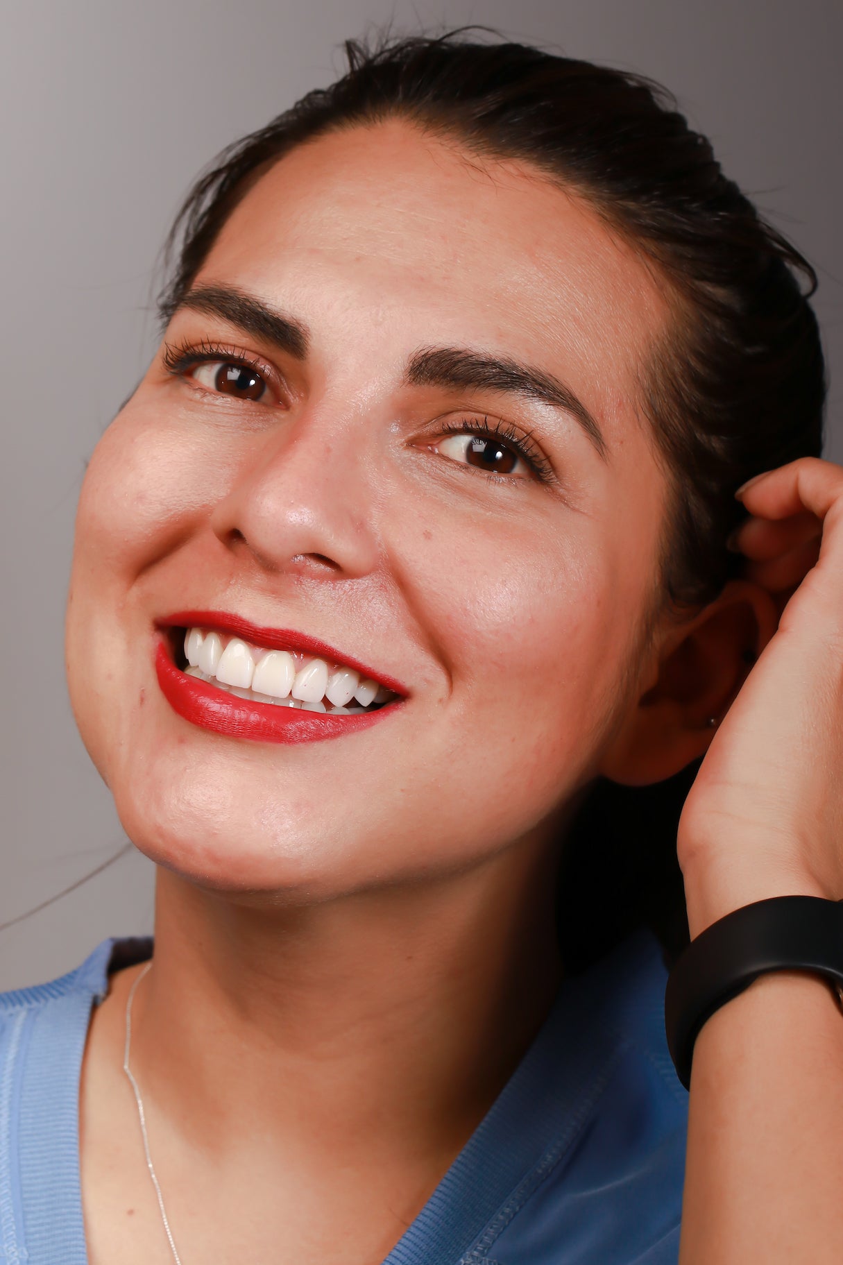 Carillas-dentales-drdanielcapetillo-esteticadental-veneers-carillasmexico