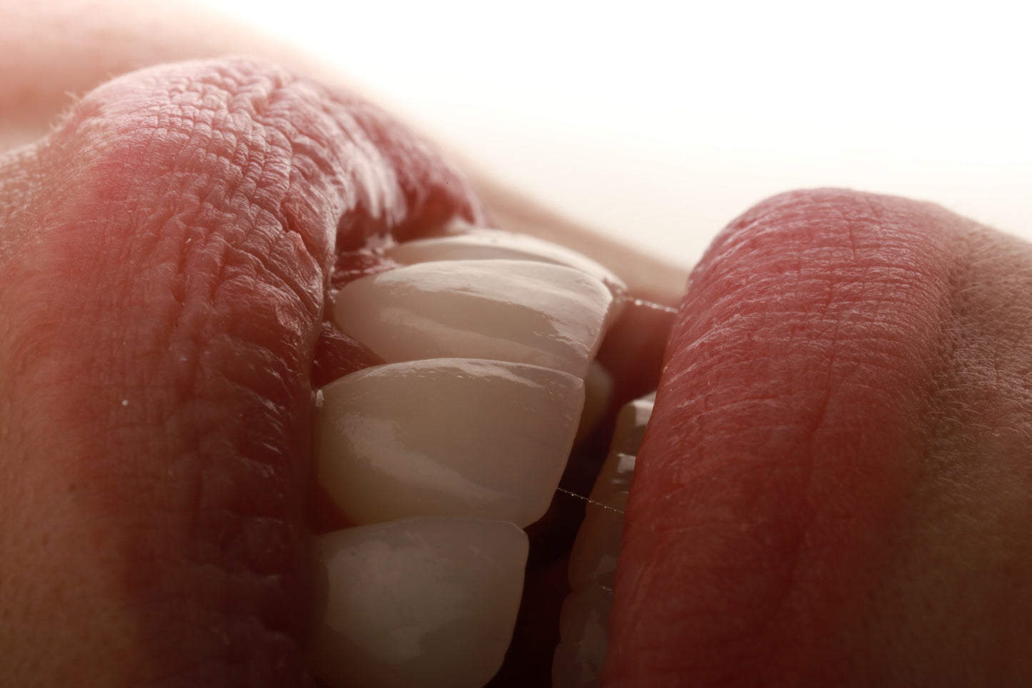 Limpieza dental